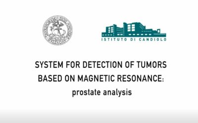 System for detection of tumors based on magnetic resonance: prostate analysis (video)