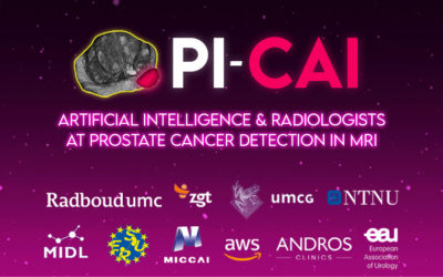 Τhe PI-CAI challenge: Artificial intelligence and radiologists at prostate cancer detection in MRI