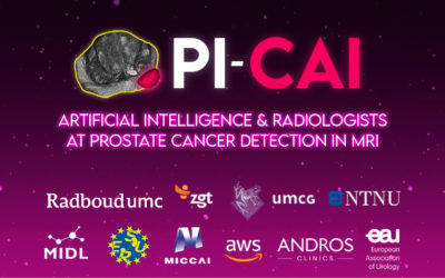 Guerbet wins PI-CAI Grand Challenge on detection of prostate cancer