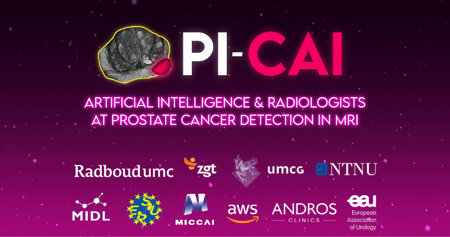 Τhe PI-CAI challenge: Artificial intelligence and radiologists at prostate cancer detection in MRI