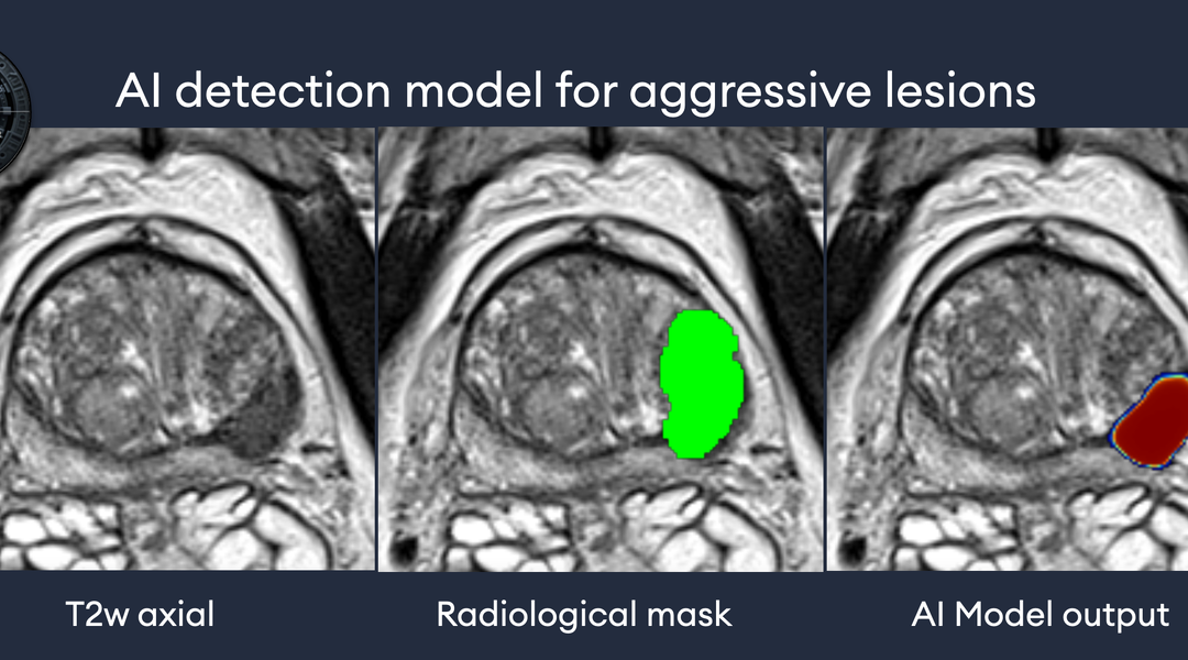 Exploring the Intersection of mpMRI and Digital Histopathology in Prostate Cancer Management: Opportunities and Challenges