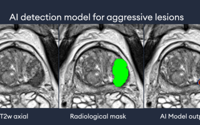 Exploring the Intersection of mpMRI and Digital Histopathology in Prostate Cancer Management: Opportunities and Challenges